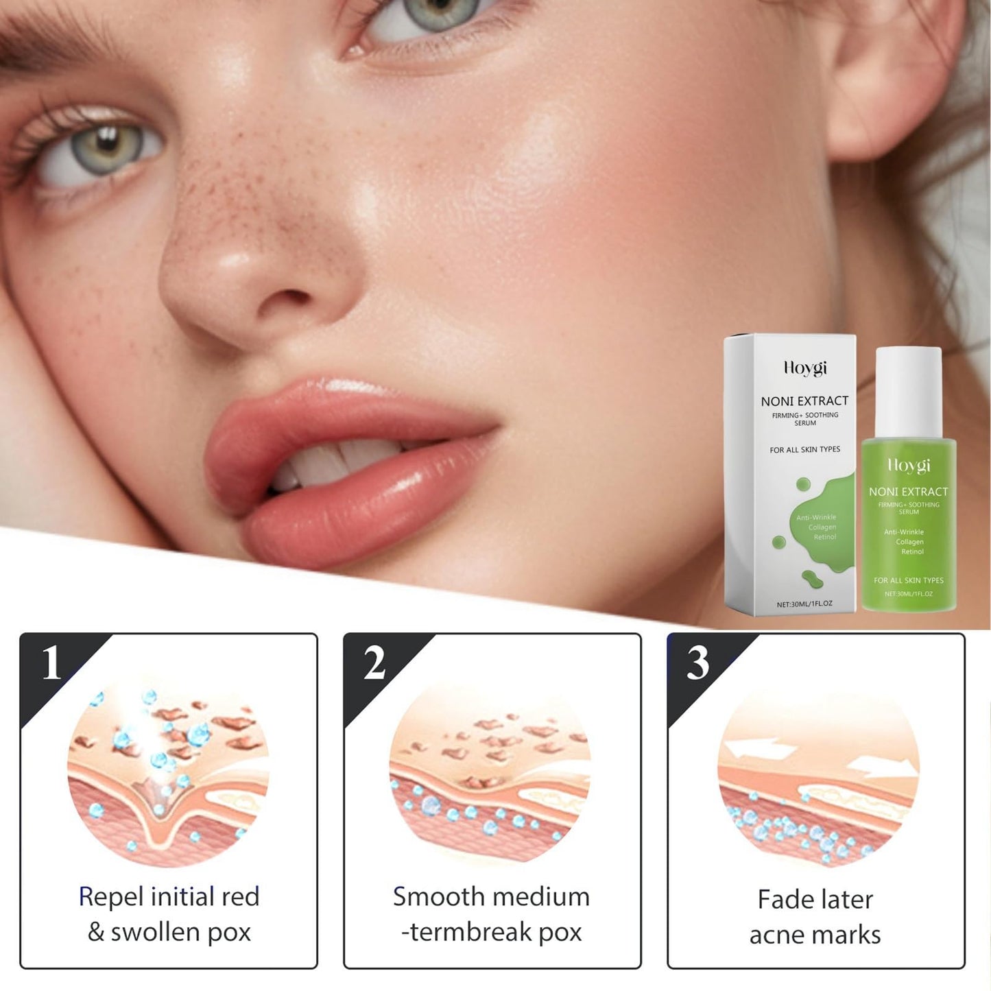 30ml Noni Ampoule Serum,Noni Fruit Serum,Noni Serum,Noni Extract Facial Serum,Anti Wrinkle Serum,Anti Ageing Serum,Skin Serum,Face Serum for Women,Antiaging Serum,Hydrating Serum,Skincare Serum