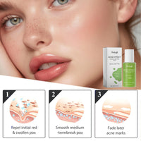 30ml Noni Ampoule Serum,Noni Fruit Serum,Noni Serum,Noni Extract Facial Serum,Anti Wrinkle Serum,Anti Ageing Serum,Skin Serum,Face Serum for Women,Antiaging Serum,Hydrating Serum,Skincare Serum