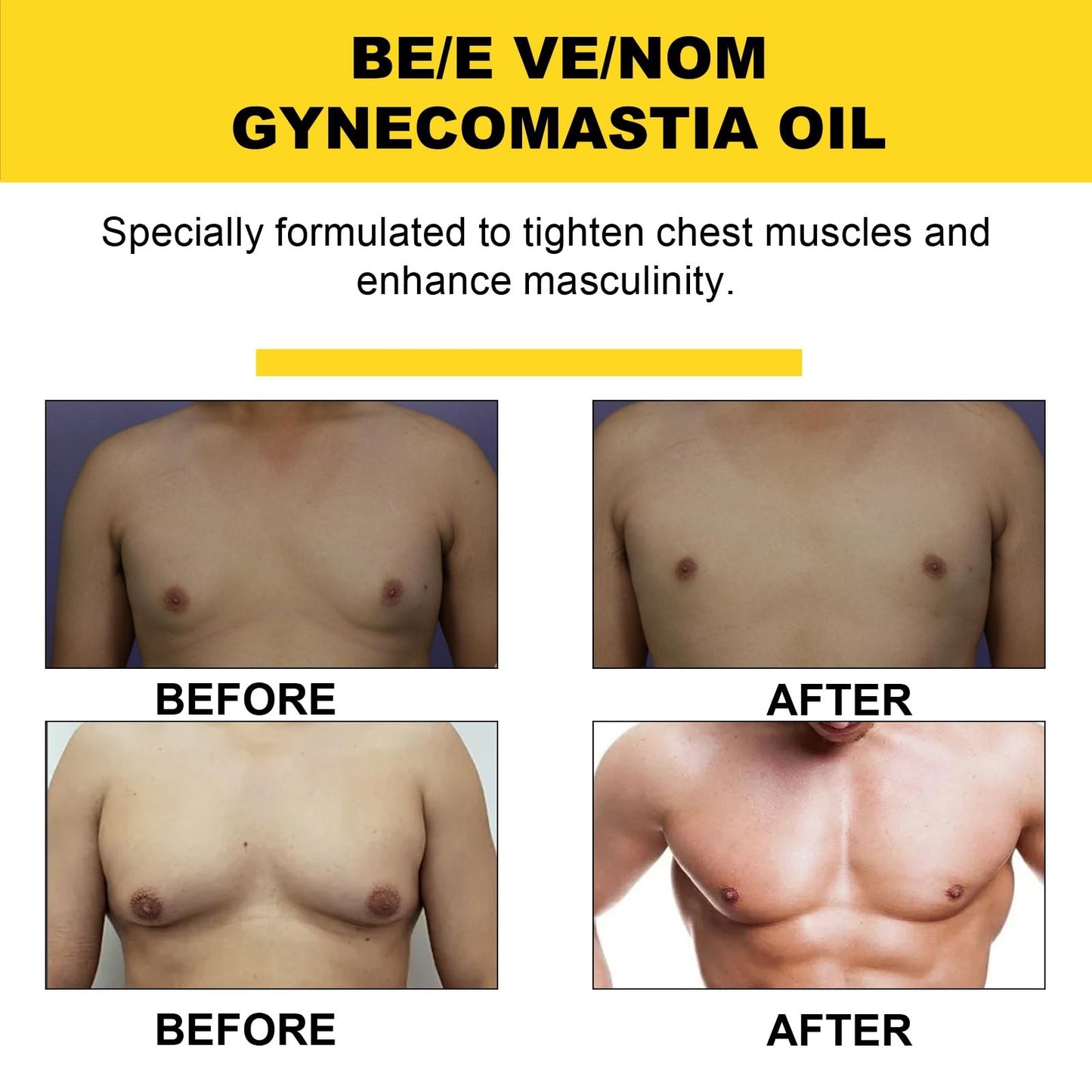 CiLiHai Therm/ofirm Be/e Ven/om Gyneco/mastia Oil,Men's Chest Muscle Oil with Tightening Formula,Gyneco/mastia Heating Oi/l for Strengthening Chest Muscles,Che/st Mus/cle O/il for Body Build & Firming