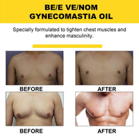 CiLiHai Therm/ofirm Be/e Ven/om Gyneco/mastia Oil,Men's Chest Muscle Oil with Tightening Formula,Gyneco/mastia Heating Oi/l for Strengthening Chest Muscles,Che/st Mus/cle O/il for Body Build & Firming