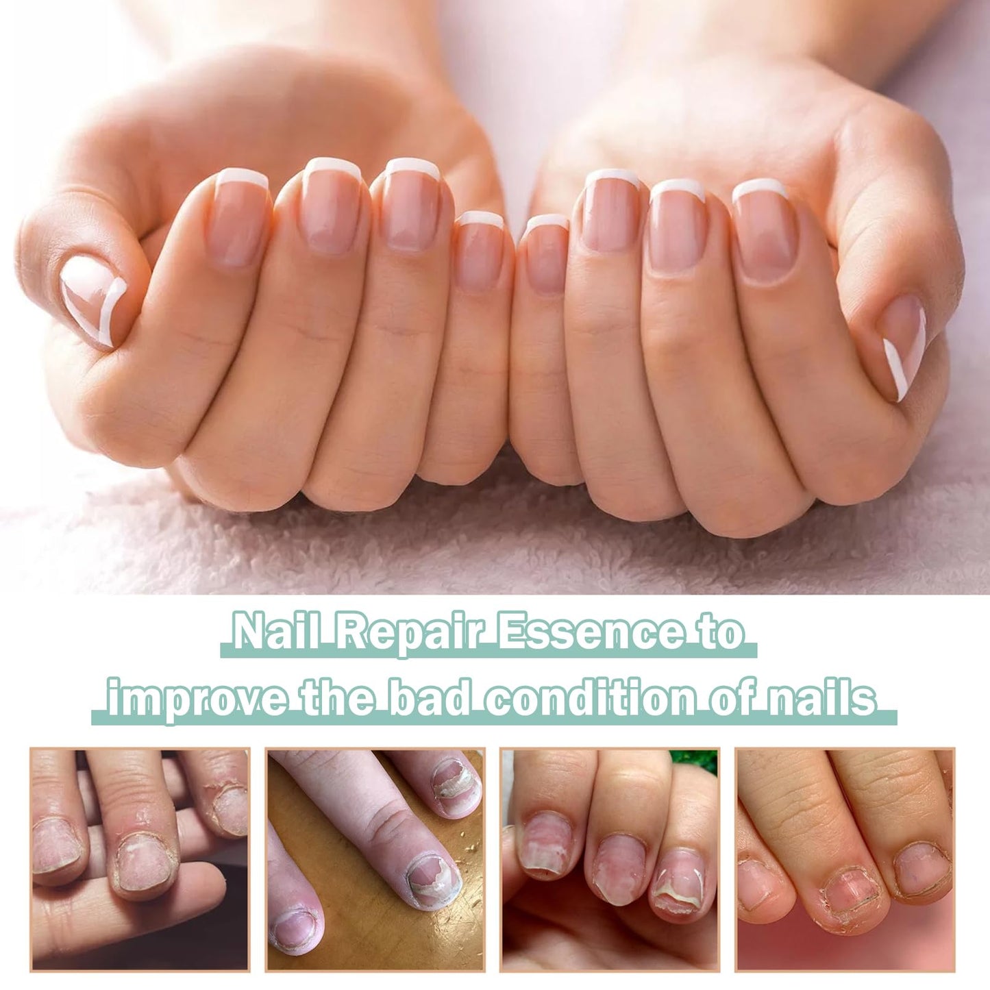 Nail Care Pens, 5Pcs Fungal Nail Treatment Pens, Fungal Nail Treatment for Toenails, Nail Repair Pen, Natural Ingredients Nail Serum for Strengthener Nail