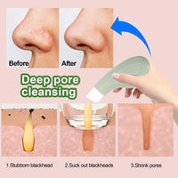 DOOCECIY Nose Pore Blackhead Scraper for Women Men Deep Skin Cleaning