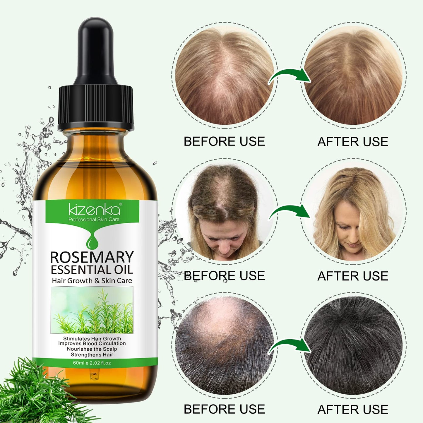 XAYGHE Rosemary Oil for Hair Growth (2PCS), Rosemary Essential Oil for Hair Growth & Skin Care, Pure Natural Hair Oil Serum, Strong Hair Root, Eyebrow and Eyelash Growth Massage Oil- 60ml*2 (60ml*2)