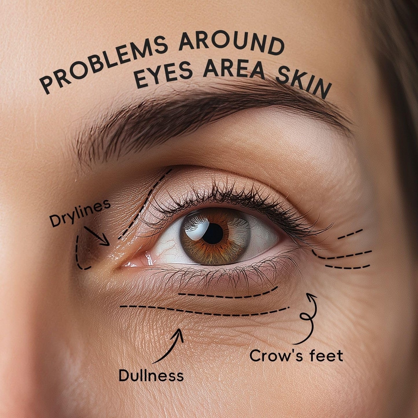 Cureluxe 12Pairs Sakura Eye Patches for Dark Circles - Eye Masks for Puffy Eyes - Eye Mask for Fine Lines & Eye Bags - l Under Eye Gel Patche for Women & Men - Hydratin & Firming & Vegan Cruelty-Free