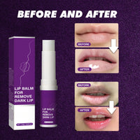 Xunzhi Lip Lightening for Dark Lips,Moisturizing L/ip Care Cream,L/ip Balm Stick,Deep Moisturization Li/p Balm,Li/p B/alm Hydrating and Brightening Dark L-ips,Li-p Repair B/alm for Dry Cracked Li-ps,5g