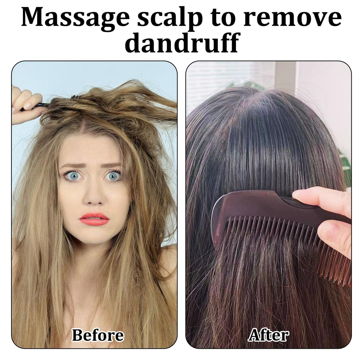 MADGININE 4-in-1 Multifunctional Hair Beauty Tool - Dandruff, Psoriasis, Lice & Scalp Comb for Women & Men - Promotes Scalp Health & Shiny Hair