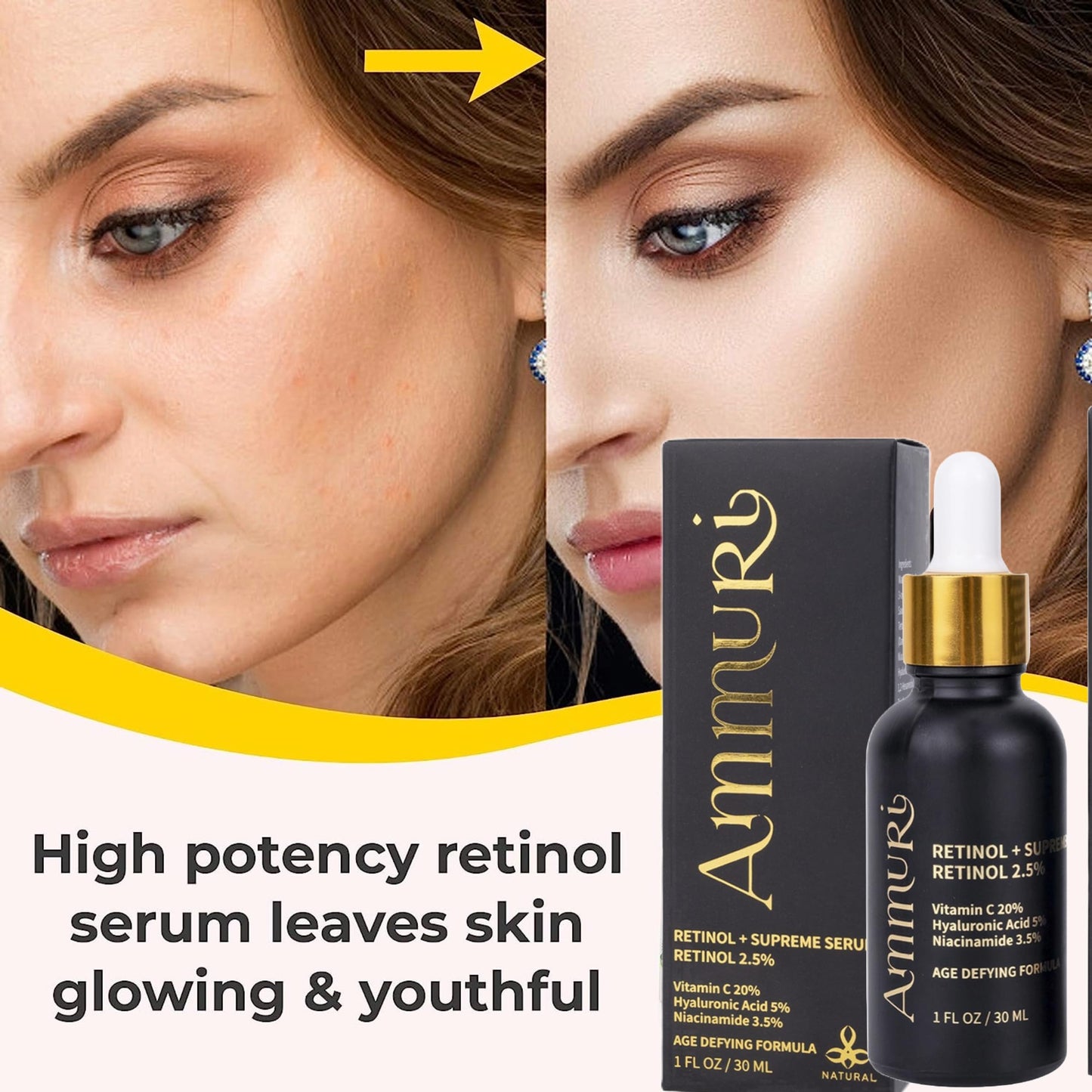 Ammuri Retinol + Supreme Serum 2.5% Vitamin C 20% with Hyaluronic Acid & Vitamin E, Face Serum, for Wrinkles, 5% Niacinamide 3.5% Anti Aging Skin Repair, Supercharged Face Serum