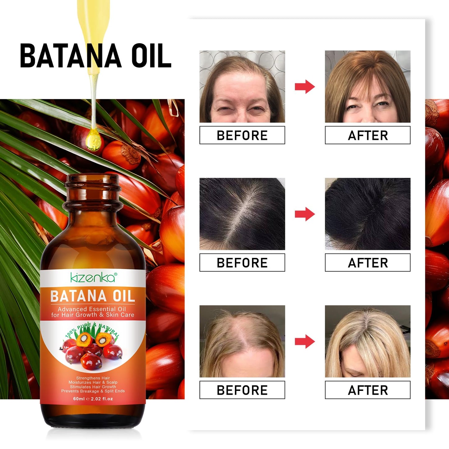 OBNOSWLPJMN Batana Oil for Hair Growth 60ml,100% Pure & Natural Batana Oil for Healthier Thicker Fuller Hair,Eliminate Hair Split Ends, Prevents Hair Loss & Breakage & Skin for Men & Women 60ml (120ml)