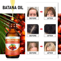 OBNOSWLPJMN Batana Oil for Hair Growth 60ml,100% Pure & Natural Batana Oil for Healthier Thicker Fuller Hair,Eliminate Hair Split Ends, Prevents Hair Loss & Breakage & Skin for Men & Women 60ml (60ml)
