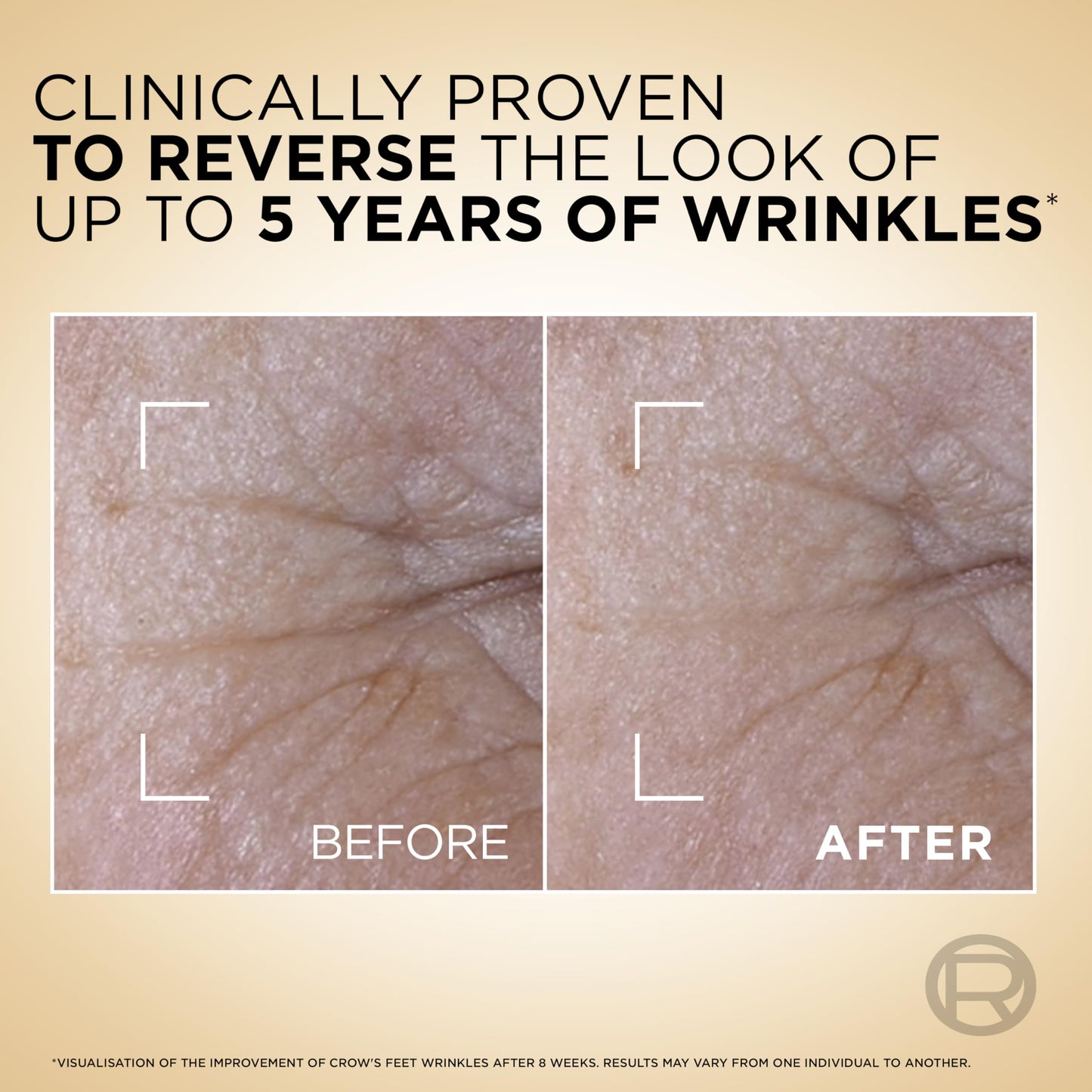 L'Oréal Paris Age Perfect Le Duo Serum Age Defying, Collagen Peptide Booster and Vitamins B3 & C, Instant Firmness, Radiance, Wrinkles Appear reduced, 30ml