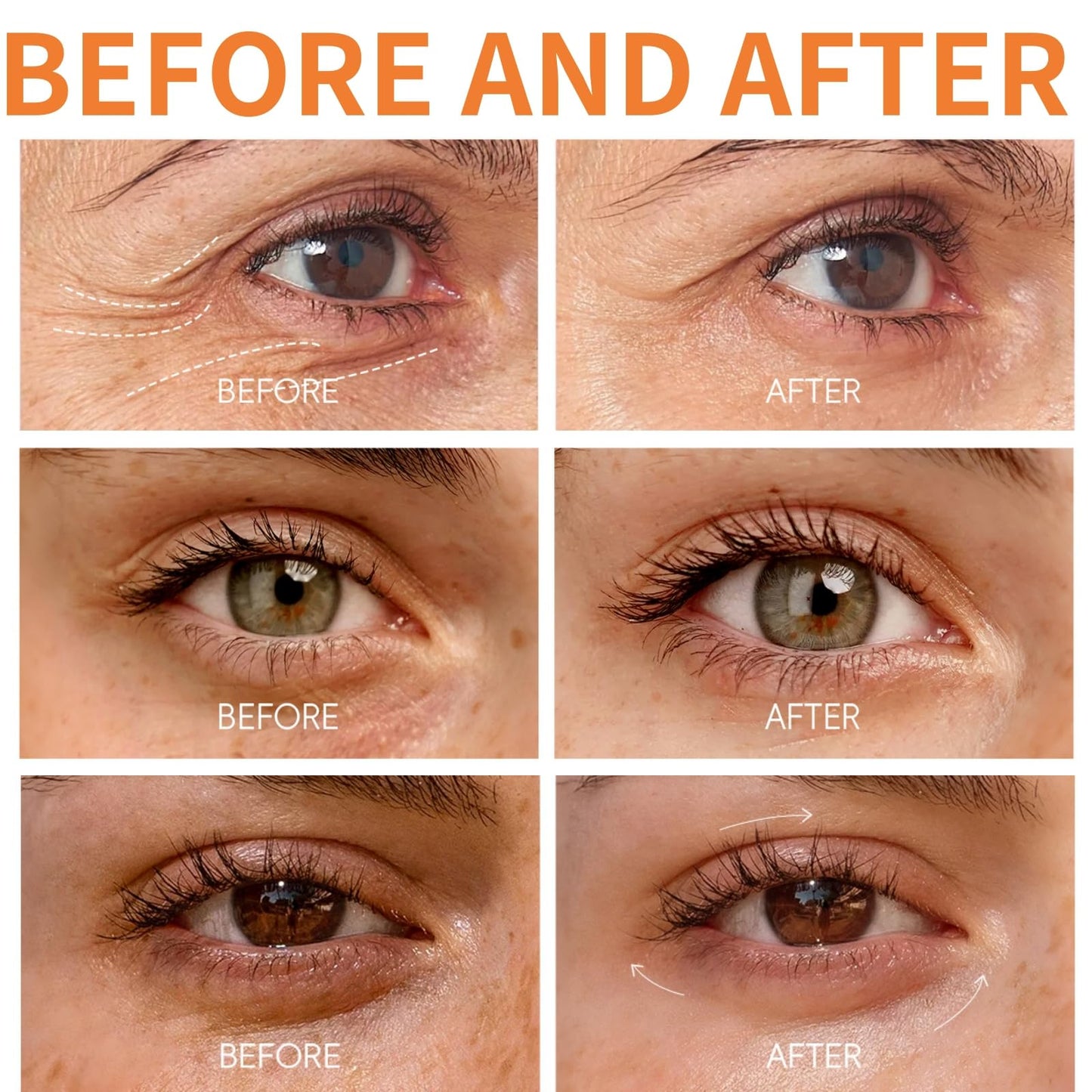 2PCS Lumibalm for Under Eye Bags & Puffiness,Stick for Dark Circles,Lumibalm Erases E/ye Bags,Turmeric Retinol E/ye Cream Stick,Lumibal/m Stic/k,Hydrating Eye Balm Sti/ck,Lumib/alm Ey/e Serum