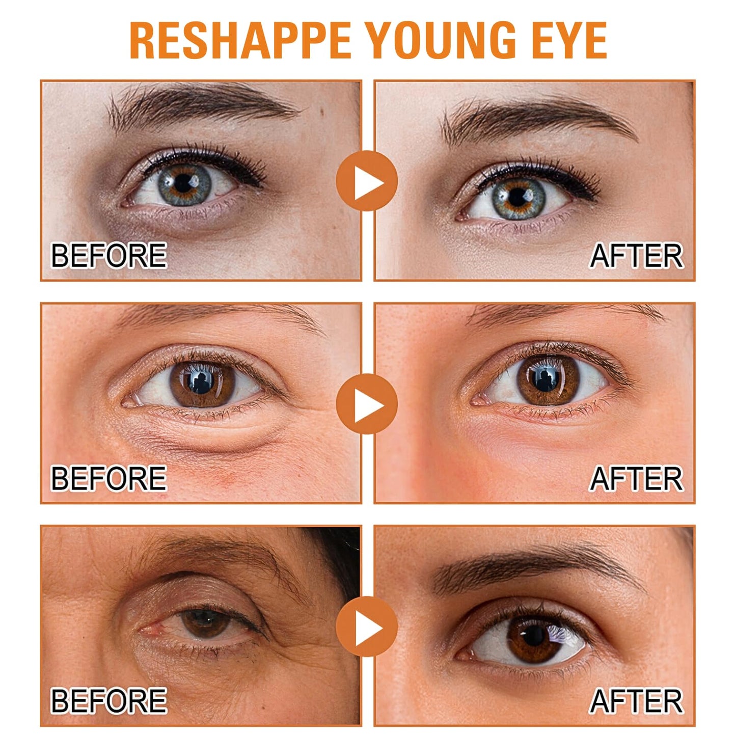 Eye Cream For Dark Circles, Vitamin C Eye Cream For Dark Circles And Puffiness, Anti Wrinkle Eye Cream, Vitamin C Eye Bag Cream For Women/Men, Brightening Eye Cream Anti Aging, Eye Care Products