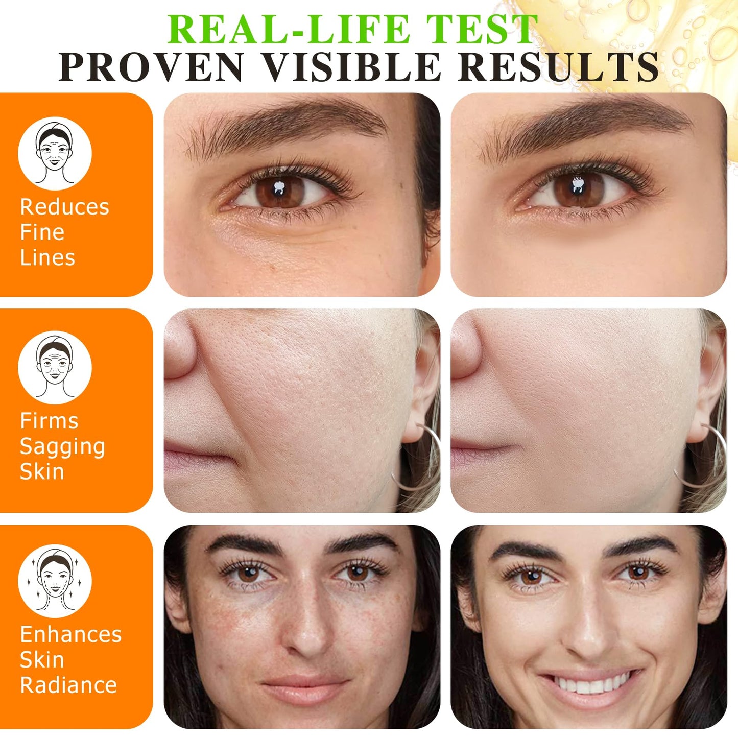 Generic Vitamin C Serum for Face Hyaluronic Acid Powerful 20% Vit C Serum for Dark Spots, Wrinkles & Fine Lines Anti Aging, Collagen Boosting & Skin Brightening Facial Serum Skin Care Women/Men 60ml