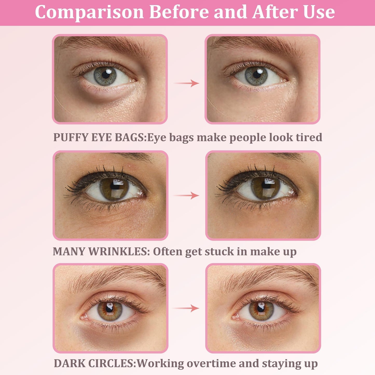 CGBOOM Under Eye Patches, Collagen Under Eye Mask, Dark Circles Under Eye Treatment, Puffy Eyes Bags Under Eyes Removal, Anti-Aging, Reduce Wrinkle, Skincare, Hydrating - 30 Pairs (Rose)