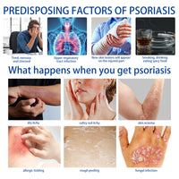 Herbal Skin Relief Cream with Aloe Vera – Soothing Moisturizer for Dry Skin – Lightweight, Non-Greasy Daily Hydration for All Types(2pcs) (2PCS)