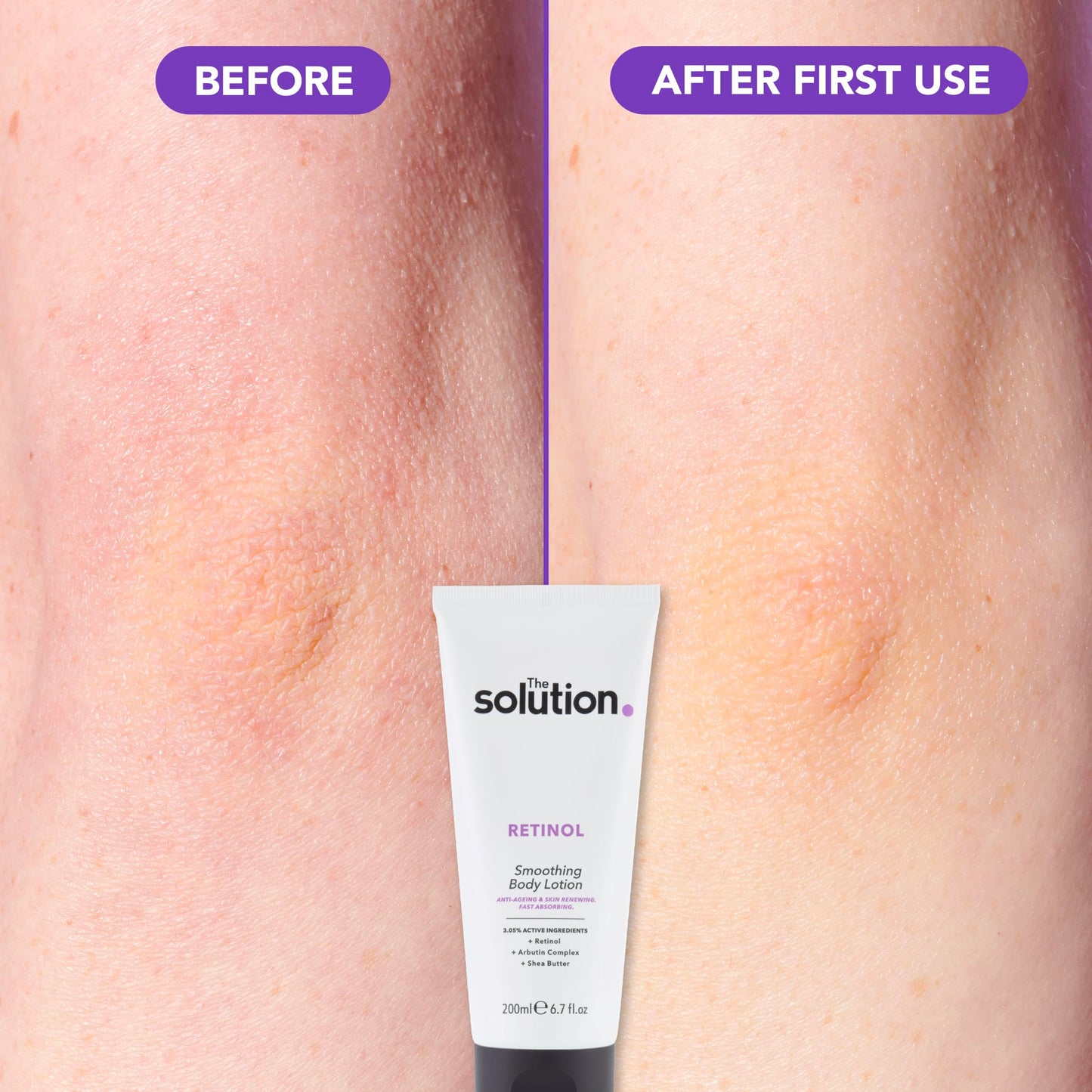 The Solution The Solution Retinol Smoothing Body Lotion 200 ml (Packaging may vary)