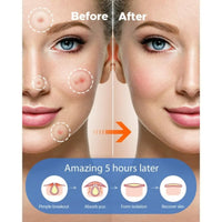 Generic Acne Patches - Pack of 24 Translucent Hydrocolloid Pimple Patch Spot Treatment Stickers for Face and Body - Fast-Acting, Vegan & Cruelty Free Skin Care