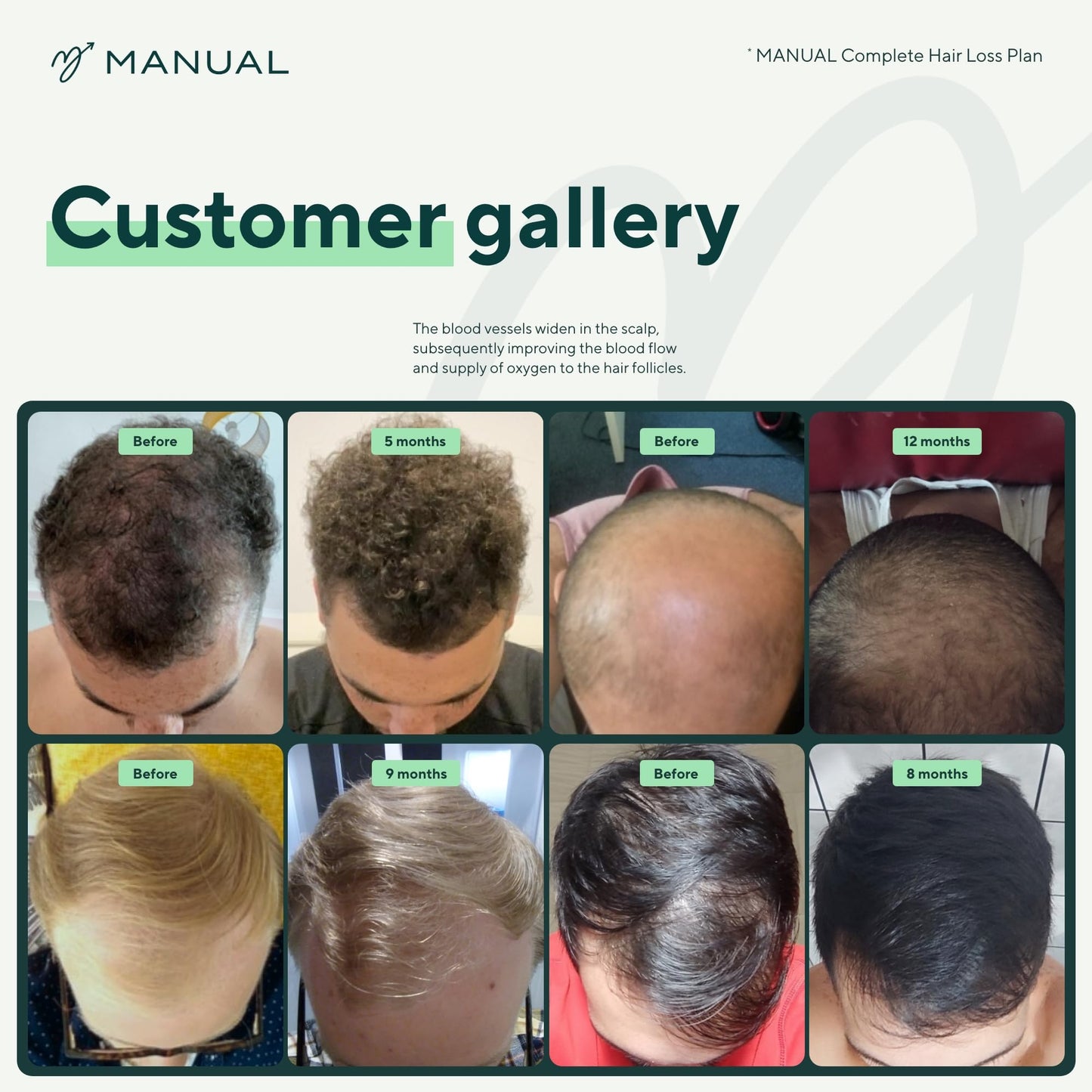 Manual Hair Growth Vitamin Supplements (30 Capsules) - for Thicker & Healthier Hair - with Multiple Vitamins Including Biotin & Collagen - for Hair Loss & Thinning - Take 1 Daily - 1 Month Supply