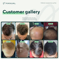 Manual Hair Growth Vitamin Supplements (30 Capsules) - for Thicker & Healthier Hair - with Multiple Vitamins Including Biotin & Collagen - for Hair Loss & Thinning - Take 1 Daily - 1 Month Supply