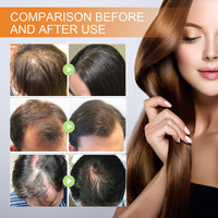 OuXing 237ml Gentle Hair Growing Shampoo,Hair Regrowth Shampoo,Root Activator Sham-poo,Mild Formula Suitable,Ha-ir Loss Sham-poo,Support Ha-ir Health and Reduce Ha-ir Fall,Sham-poo for Ha-ir Loss Women