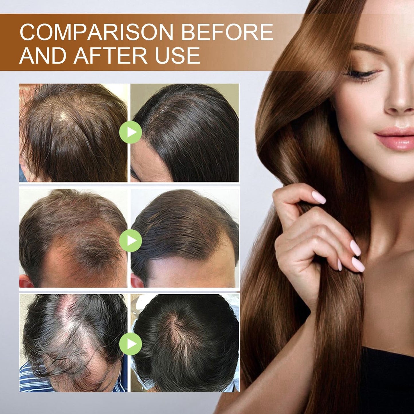 Oumun Powder for Hair Growth,Hair Loss Treatment for Women,Fast Ha-ir Growth Essence,Ha-ir Serum for Hai-r Growth,Natural Herbal Health H-air Loss Makes Growth,H-air Fall Treatment for Women