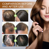 Oumun Powder for Hair Growth,Hair Loss Treatment for Women,Fast Ha-ir Growth Essence,Ha-ir Serum for Hai-r Growth,Natural Herbal Health H-air Loss Makes Growth,H-air Fall Treatment for Women