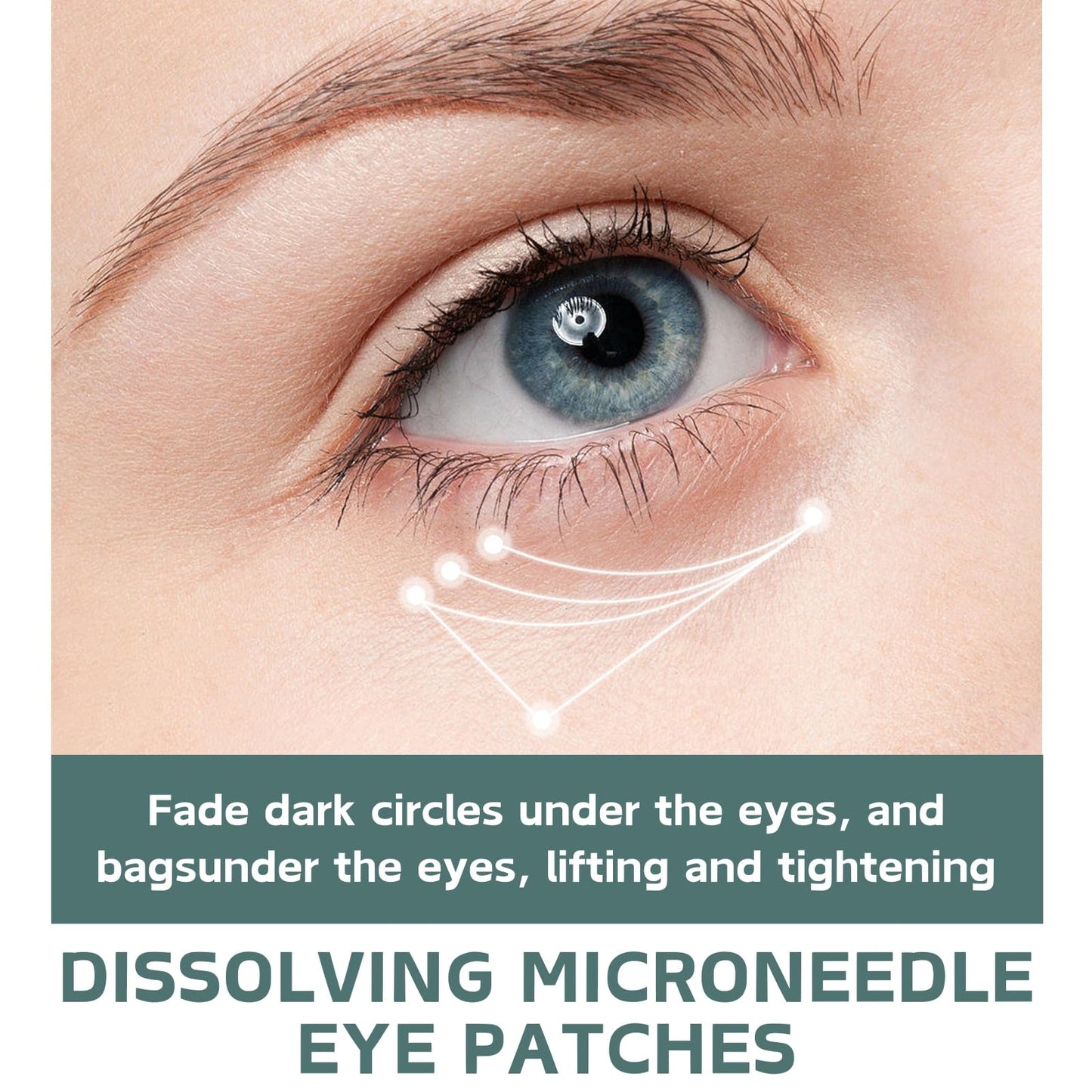 Cureluxe Pack of 5 Dissolving Microneedle Eye Patches,Dissolving Microneedle Eye Patches with Peptides,Hyaluronic acid,Glycerin,Anti Wrinkle Pat-ches,Under Eye Pat-ches for Dark Circles & Puffy Eyes