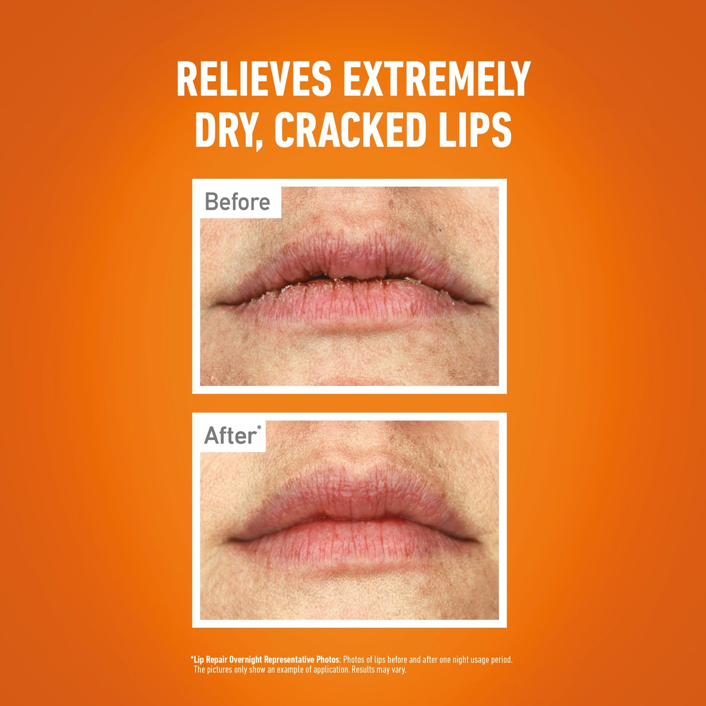 O'Keeffe's Lip Repair Overnight 7g - Intensive Overnight Treatment for Dry, Cracked Lips, Long-Lasting Moisture & Repair