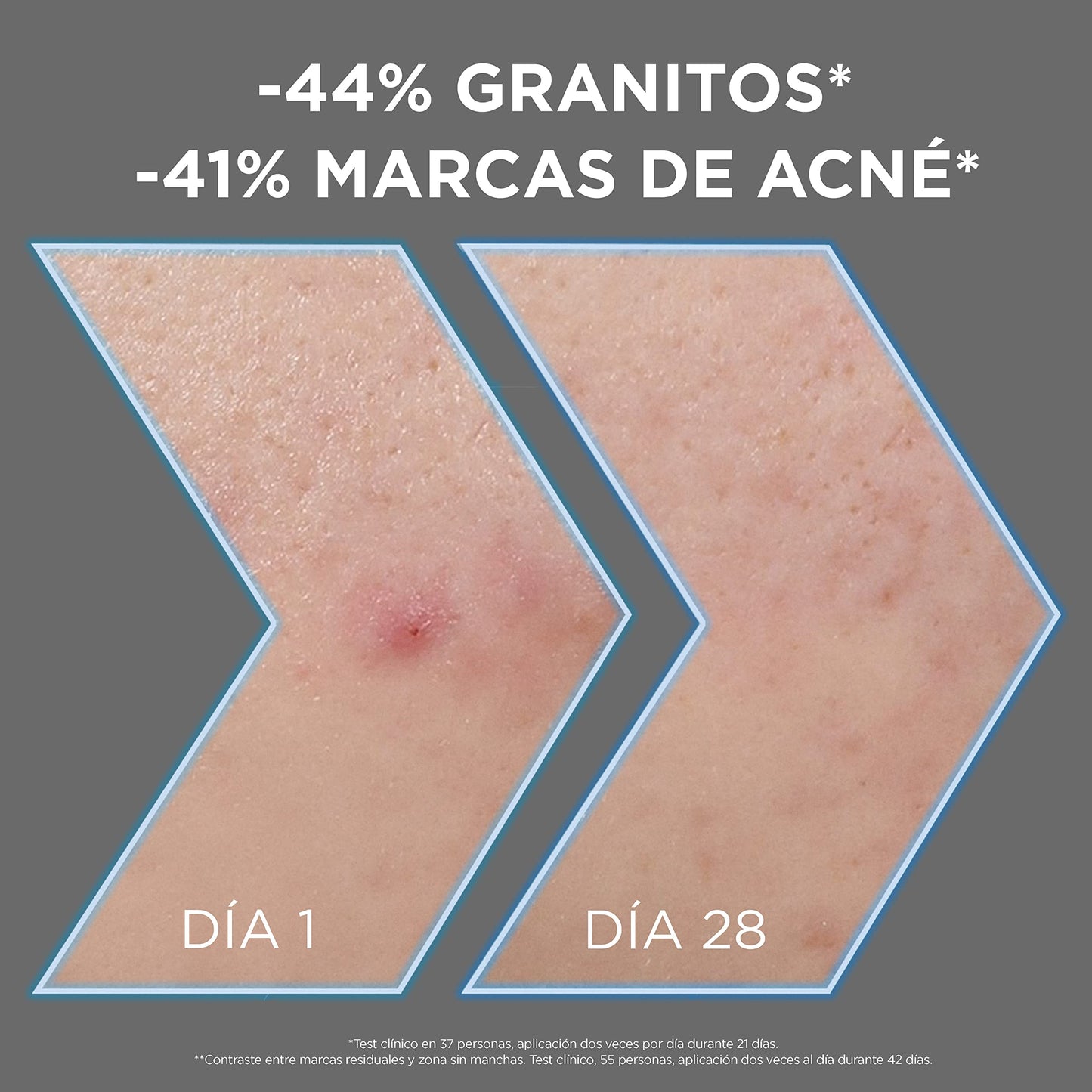 Pure Active AHA + BHA + Carbón Sérum Anti-Impregnancy 30 ml