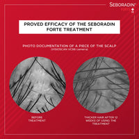 Seboradin Forte Hair Growth Serum Ampoules 28 x 5,5 ml Anti Hair Loss Serum Chronic Hair Loss and Thinning Treatment Natural Extracts and Vitamins Hair & Scalp Treatment Hair Care & Products