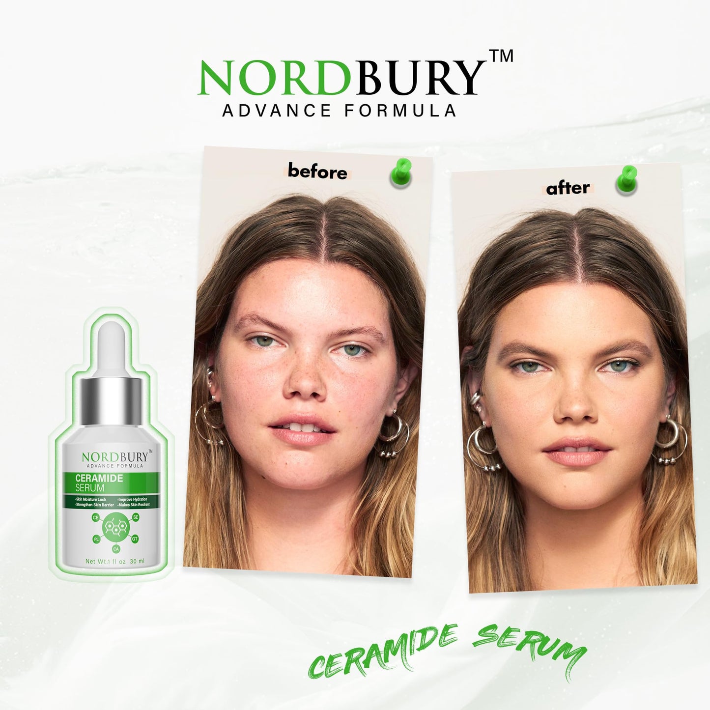 NORDBURY Ceramide Serum, 5X Ceramide with Panthenol Centella Aisatica Green Tea & Squalane, Skin Moisture Lock Strengthen Skin Barrier Improve Skin Hydration & Resilience Day and Night