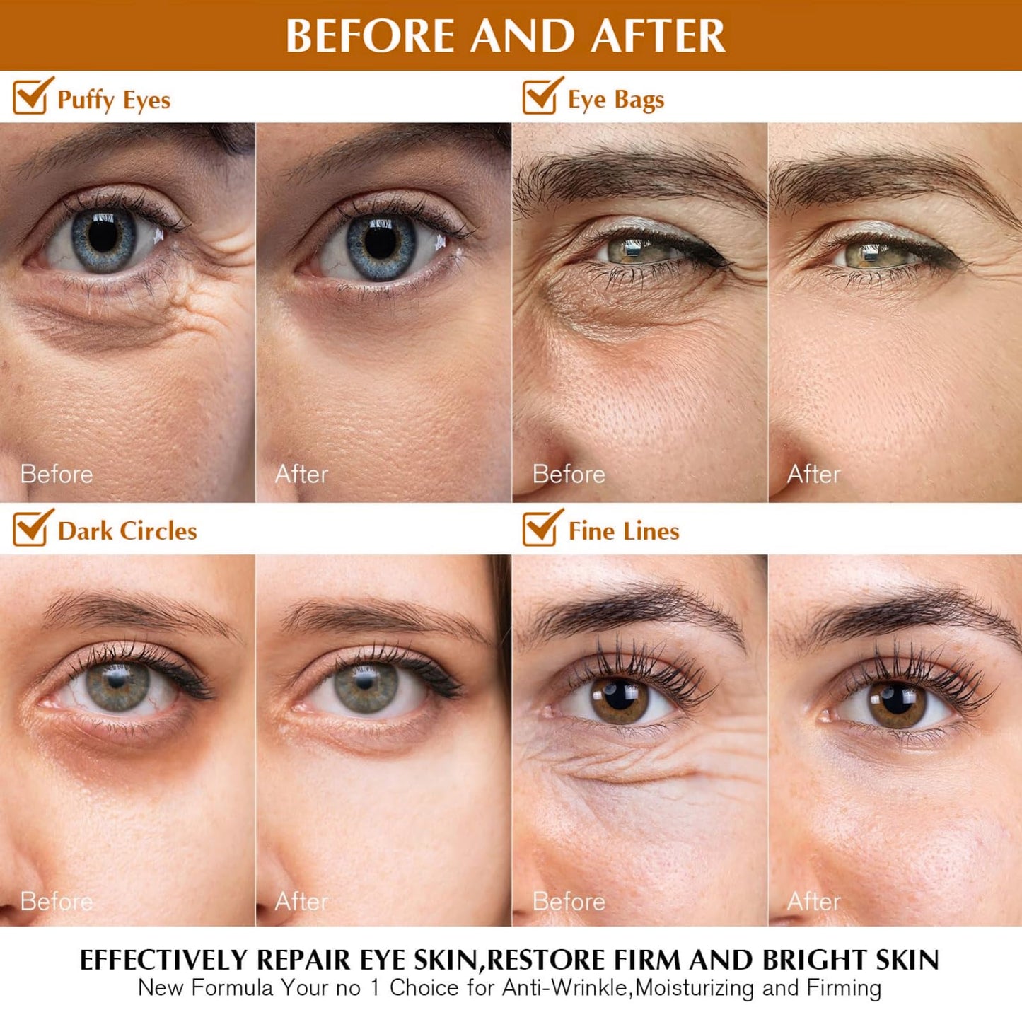Snake Venom Eye Cream - Anti Wrinkle Eye Cream For Puffiness + Wrinkles, Brightening Under Eye Cream, Diminishing Deep Wrinkles Dark Circle Eye Cream, Eye Bag Treatment For Men And Women, 30g