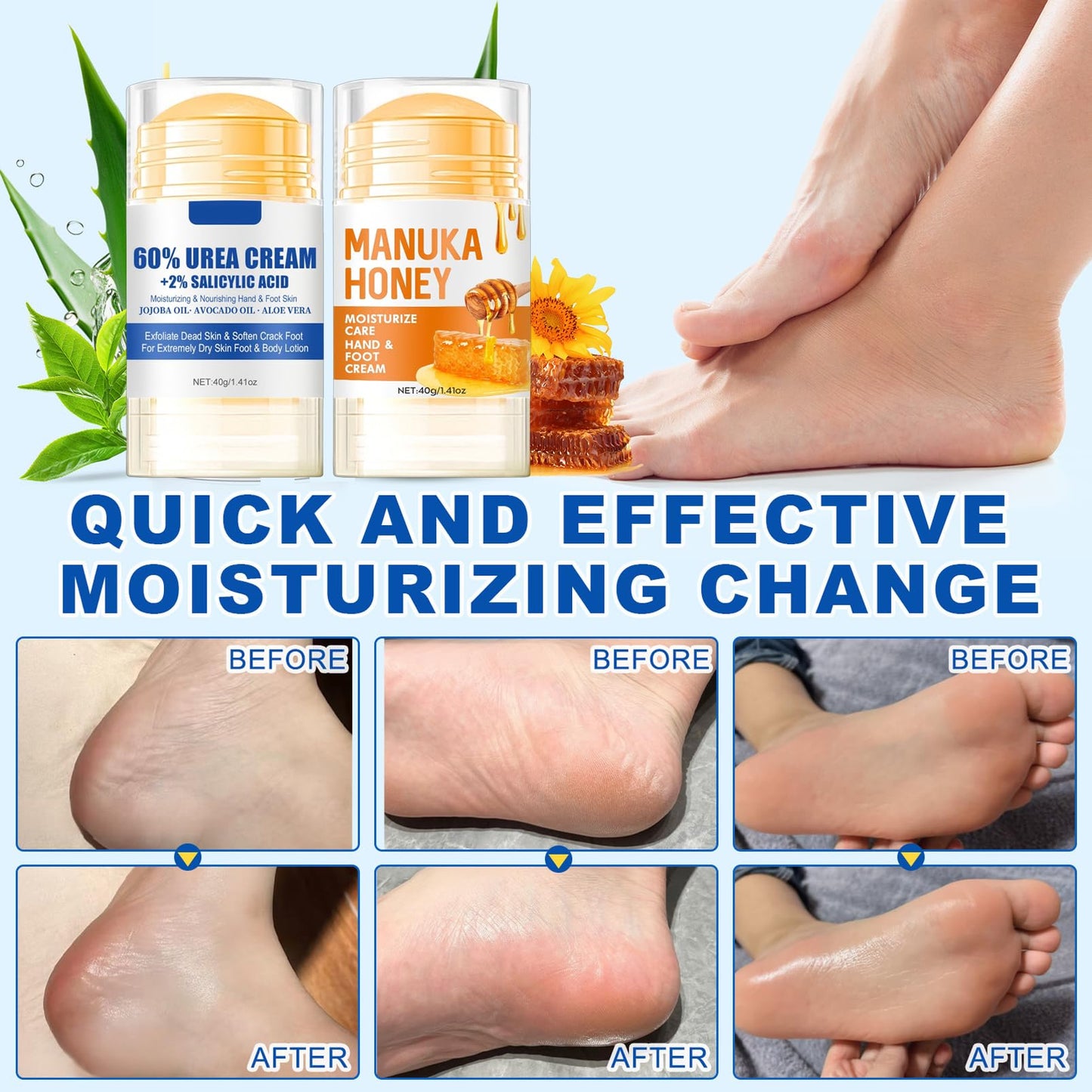 DMQ Urea Foot Cream, 2PCS Foot Cream for Cracked Heels and Dry Skin, Honey Cracked Heel Repair Cream, Urea Cream Foot Moisturiser (1.41 Ounce (Pack of 2), Aloe Vear & Honey)
