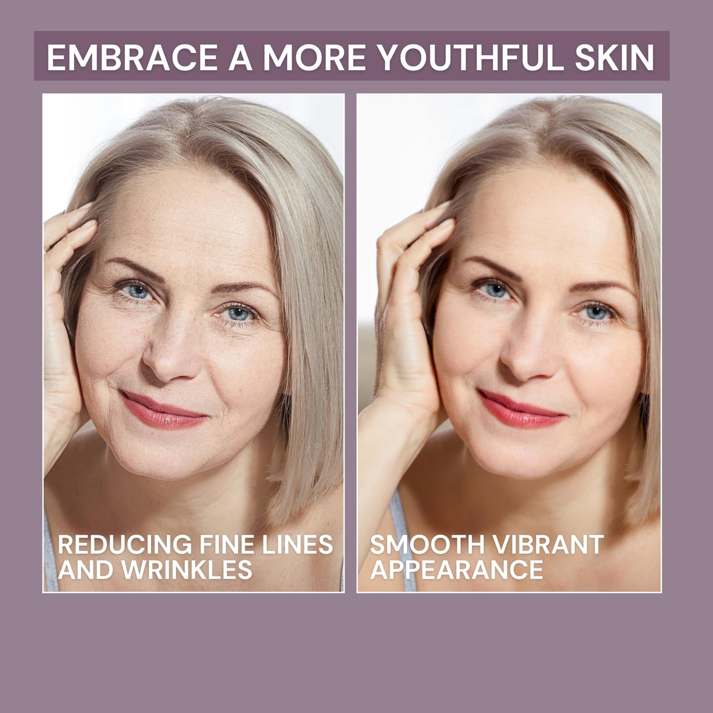 Ammuri AmmuRi Anti-Aging Serum with Matrixyl 3000, Vitamin C, Hyaluronic Acid, Organic Aloe Vera, for Wrinkles, Lines, Acne, Sensitive Skin 30ml