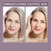 Ammuri AmmuRi Anti-Aging Serum with Matrixyl 3000, Vitamin C, Hyaluronic Acid, Organic Aloe Vera, for Wrinkles, Lines, Acne, Sensitive Skin 30ml