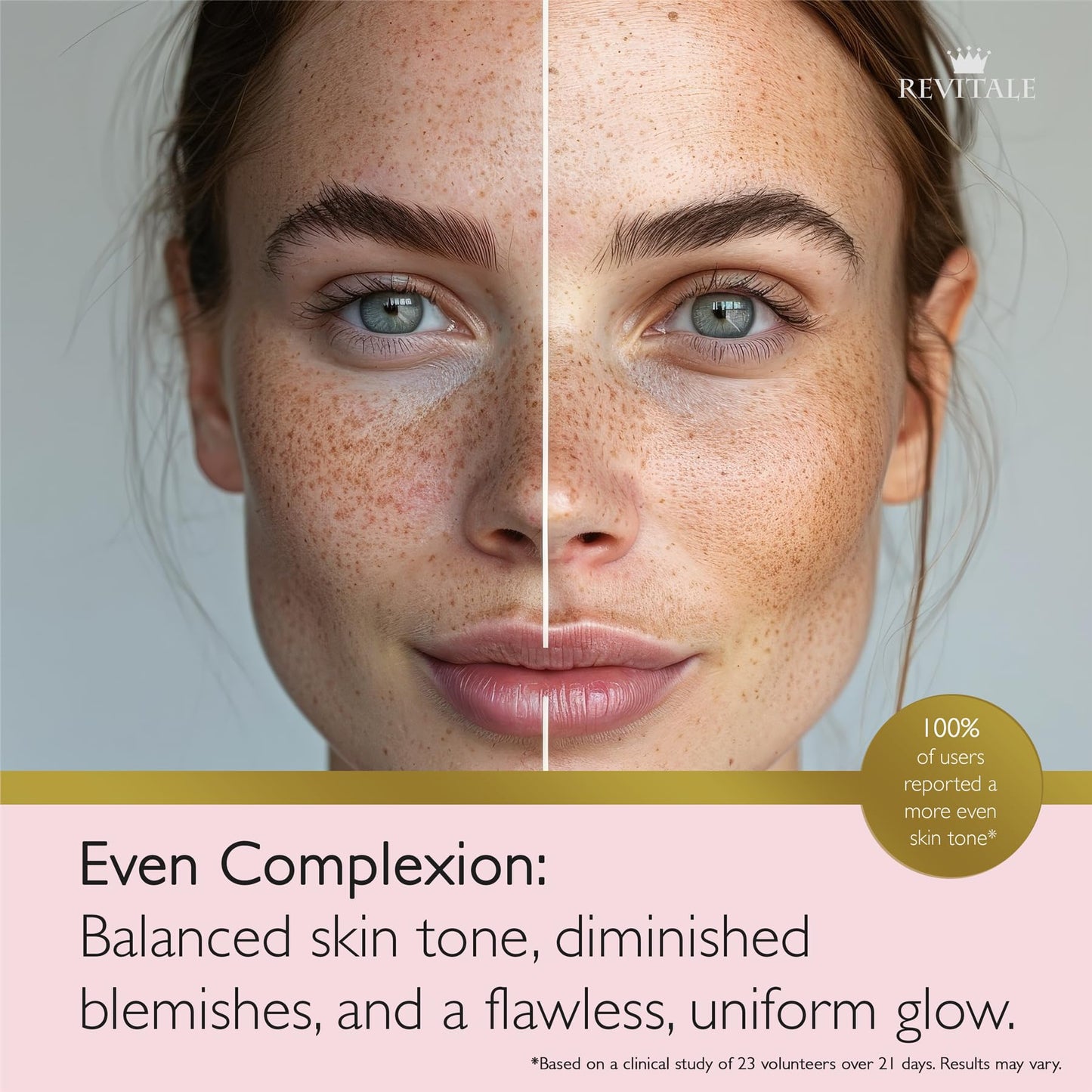 Revitale Advanced Salicylic Acid Cream for Face & Body 80g – Helps Smooth & Soften Skin Texture. For Rough, Bumpy & Blemish-Prone Skin