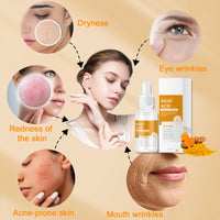 YUYUE-YY Kojic Acid Turmeric Oil Serum Face, Turmeric Oil Face Serum Enriched with Turmeric, Aloe Vera, Seaweed and Goji Berry Extracts to Illuminate Skin Tone, Anti-Aging, Skincare for Man & Women