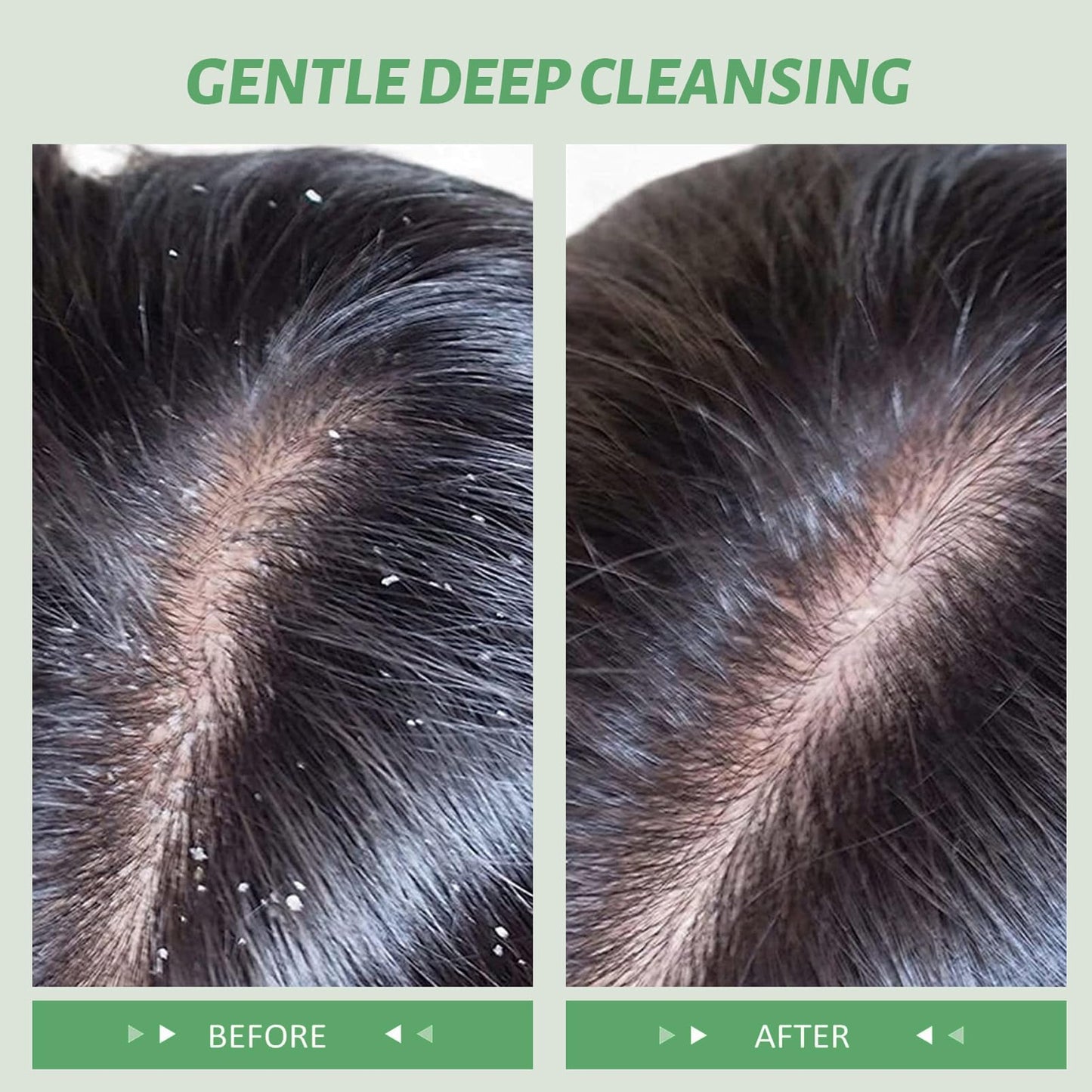 DMQ Rosemary Scalp Scrub with Mint Oil, Mint Scalp Exfoliator, Scalp Cleansing Nourishing, Prevent Hair Loss,Dandruff and Build-Up Remover, Scrub Cream with Scalp Massager, 100g
