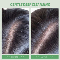 DMQ Rosemary Scalp Scrub with Mint Oil, Mint Scalp Exfoliator, Scalp Cleansing Nourishing, Prevent Hair Loss,Dandruff and Build-Up Remover, Scrub Cream with Scalp Massager, 100g