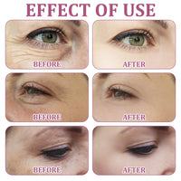 Katslyn 3 PCS Mango Revitalize Eye Cream Eyelift Serum, Mango Activating and Firming Eye Cream, Hyaluronic Acid Repair Essence for Dark Circles and Puffy