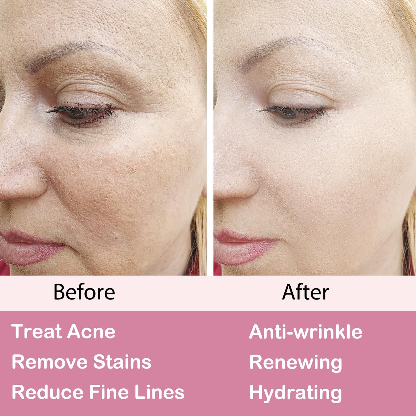 Retinol Moisturizer Cream,For Face&Eye Area Anti Aging Wrinkles & Acne & Fine Lines,with Vitamin E&Hyaluronic Acid & Jojoba Oil.Best Night&Day Facial Cream.With 2.5% Active Retinol (50Milliliter)