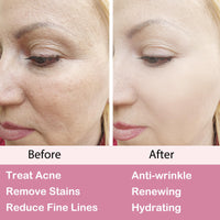 Retinol Moisturizer Cream,For Face&Eye Area Anti Aging Wrinkles & Acne & Fine Lines,with Vitamin E&Hyaluronic Acid & Jojoba Oil.Best Night&Day Facial Cream.With 2.5% Active Retinol (50Milliliter)