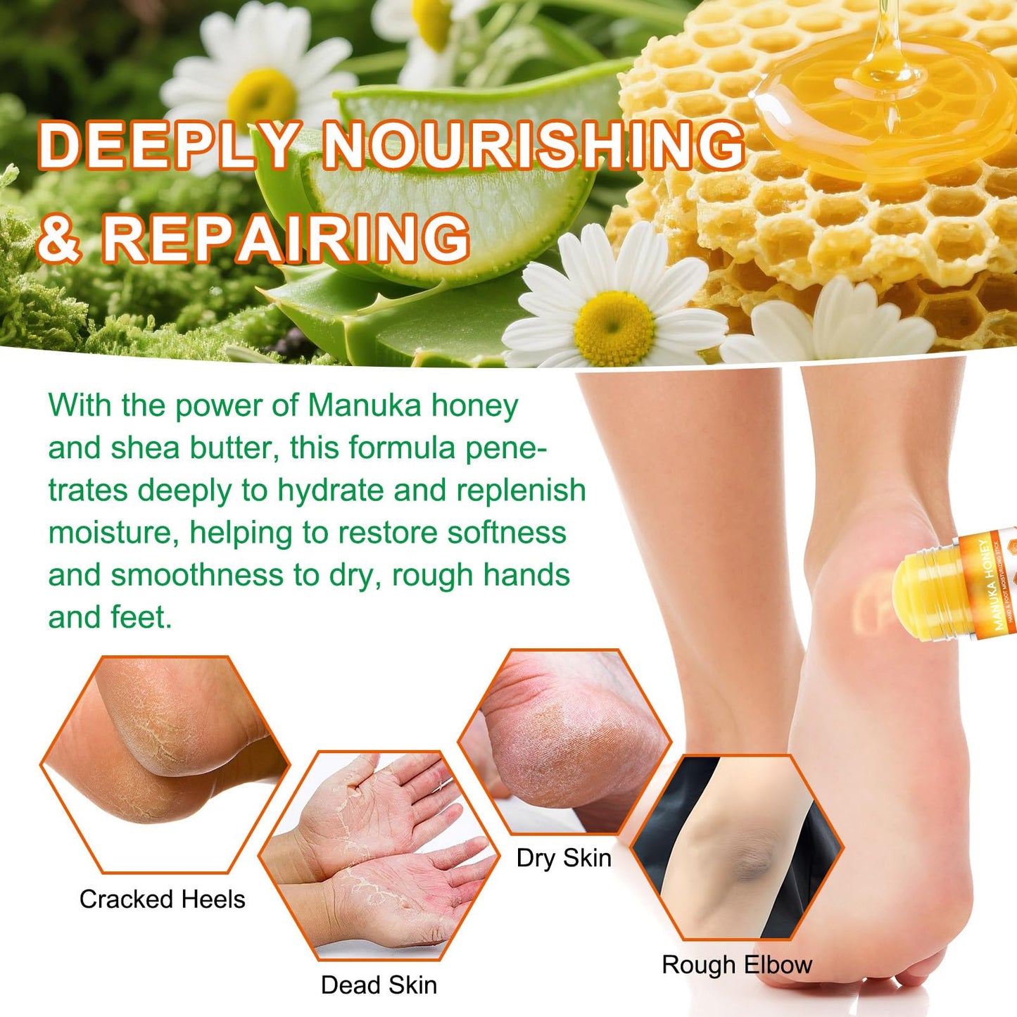 ThamGlow 2Pcs Manuka Honey Cream For Dry Feet, Cracked Heel Repair Cream, Honey Foot Balm, Softens Calluses, Exfoliates Dead Skin & Deeply Moisturises – Athletes Foot Treatment Heel Balm For Hard, Rough Skin