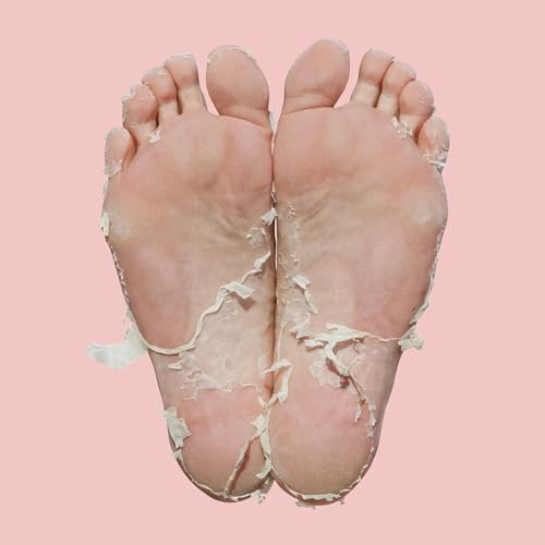 Skin Republic Pedi Foot Peel Max 15% stronger acids removes severely dry skin and cracked heels.