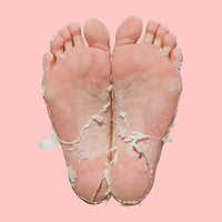Skin Republic Pedi Foot Peel Max 15% stronger acids removes severely dry skin and cracked heels.