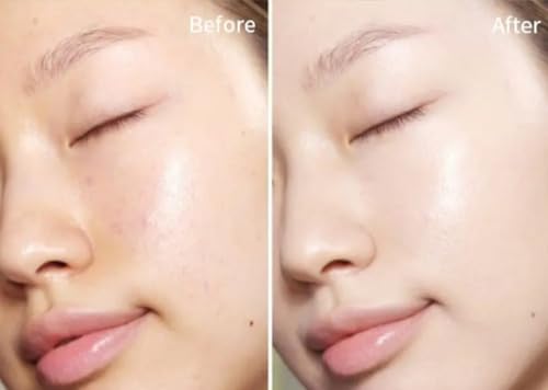 Epiphany Vibe EGF Serum for Microneedling, Micro Infusion, Mesotherapy Ampoule Serum Hyaluronic Acid Peptides Skin Repairing