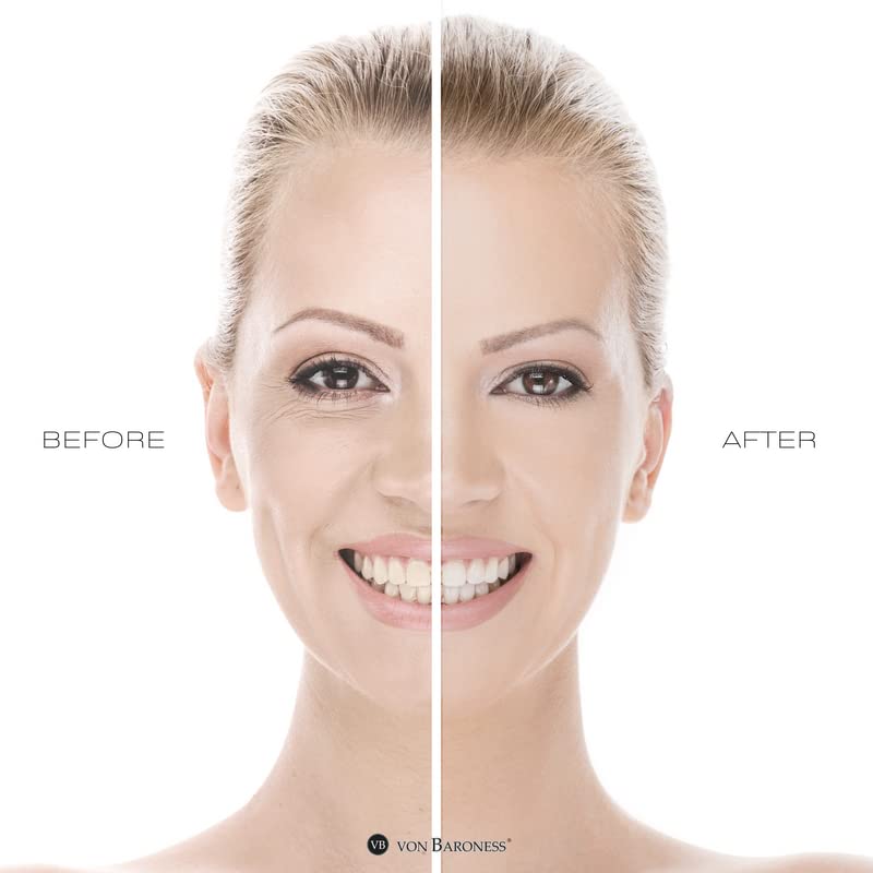 VON BARONESS Anti-Aging Face Cream - with White Caviar Extract, Retinol, Collagen, and Hyaluronic Acid - Reduce Wrinkles and Fine Lines, Deeply Hydrate, and Enhance Radiance