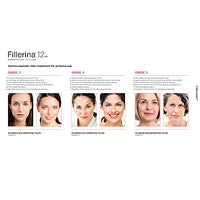 Fillerina 12 Densifying-Filler - Eyes & Eyelids Grade 3