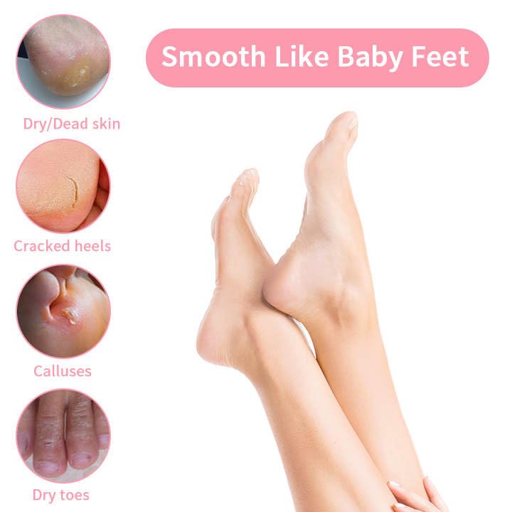 PALMARISA Palmarisa Foot Peel Mask – Exfoliating Socks for Cracked Heels & Hard Skin – Aloe Vera & Tea Tree – 2 Pairs – Baby Soft Feet in 10-14 Days, Dermatologically Tested