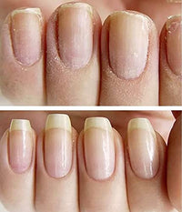 KERATIN RESEARCH NAILVIVE Nail Serum Powerful Magic-like Silk Proteins Proven Natural Formula Strengthening Hardening nails Instantly Prevents Splits Chips Peels Cracks on Your Nails